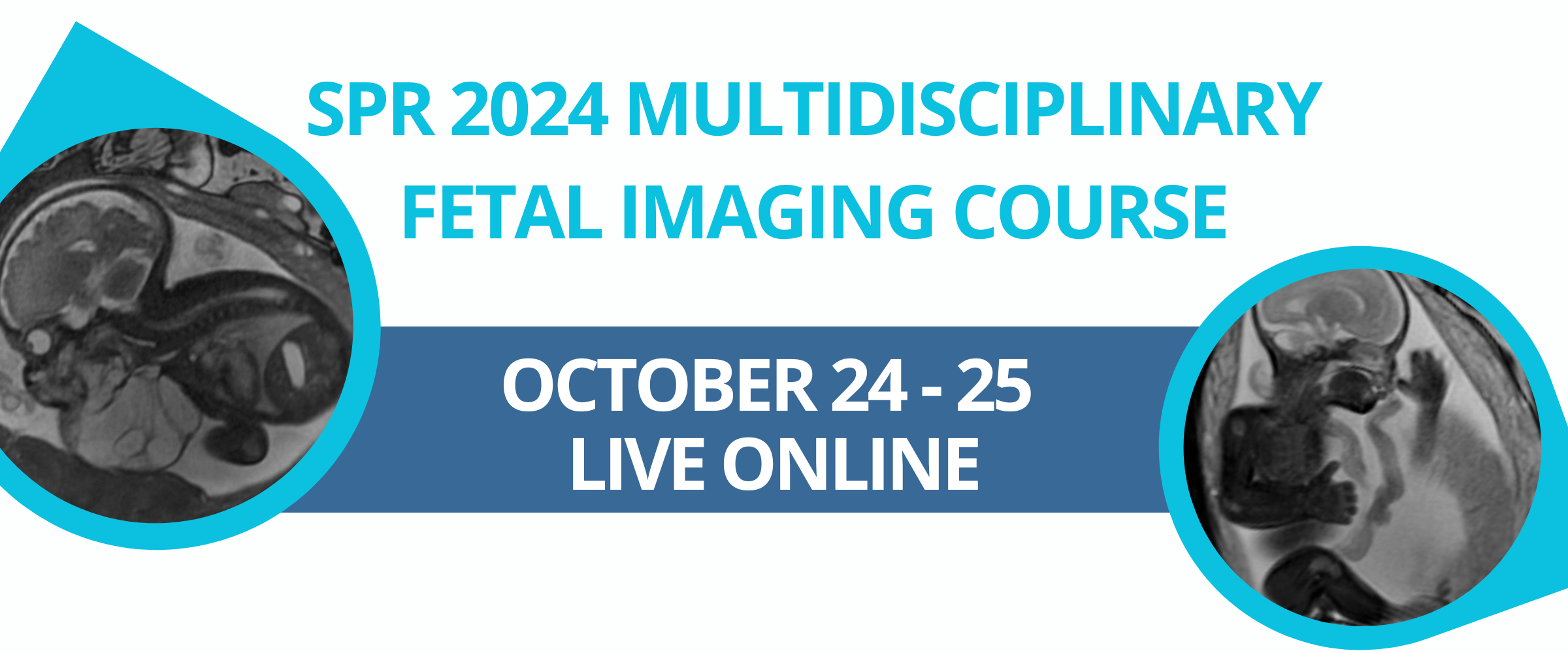 Society for Pediatric Radiology SPR 2024 Multidisciplinary Fetal Imaging Course