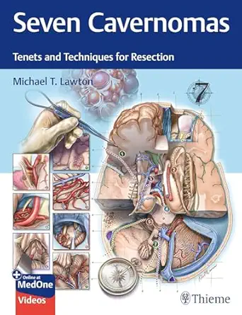 Seven Cavernomas: Tenets and Techniques for Resection (Videos Only)