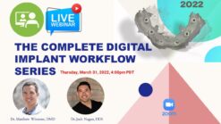 The complete digital implant workflow series